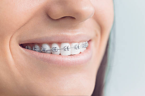 Best Invisalign and Clear Aligners  in Cave Creek, AZ